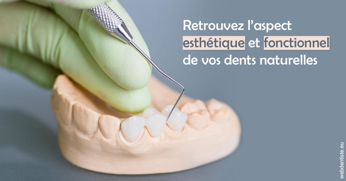 https://www.dr-chavrier-orthodontie-neuville.fr/Restaurations dentaires 1