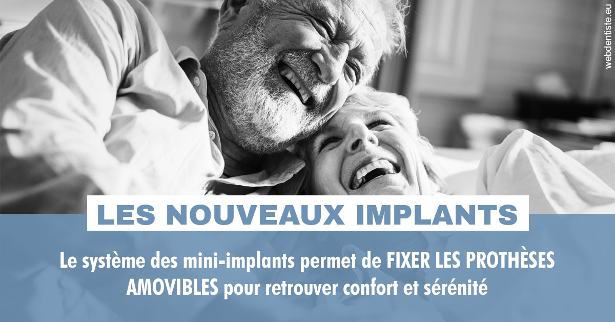 https://www.dr-chavrier-orthodontie-neuville.fr/Les nouveaux implants 2