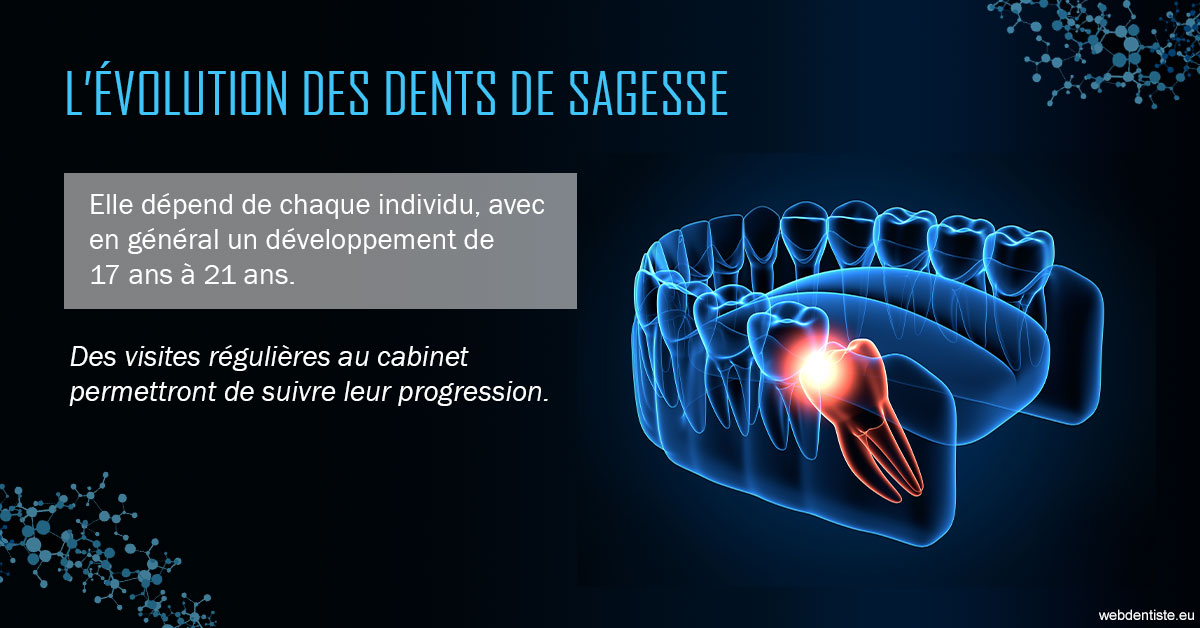 https://www.dr-chavrier-orthodontie-neuville.fr/2023 T4 - Dents de sagesse 01