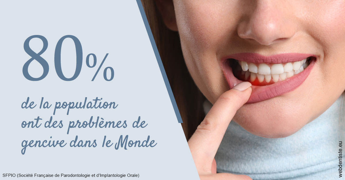 https://www.dr-chavrier-orthodontie-neuville.fr/Problèmes de gencive 2