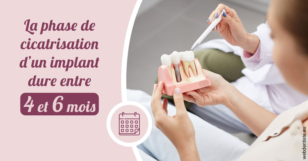 https://www.dr-chavrier-orthodontie-neuville.fr/Cicatrisation implant 2