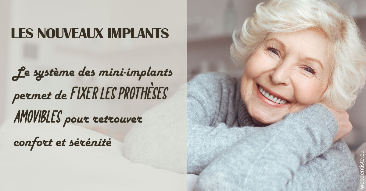 https://www.dr-chavrier-orthodontie-neuville.fr/Les nouveaux implants 1