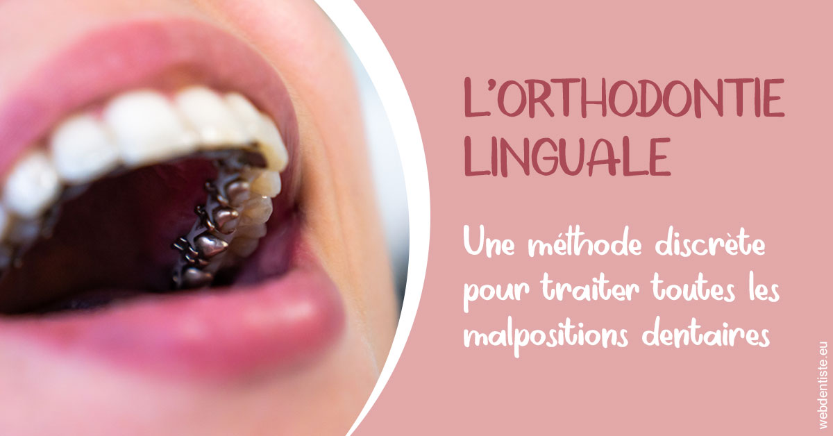 https://www.dr-chavrier-orthodontie-neuville.fr/L'orthodontie linguale 2