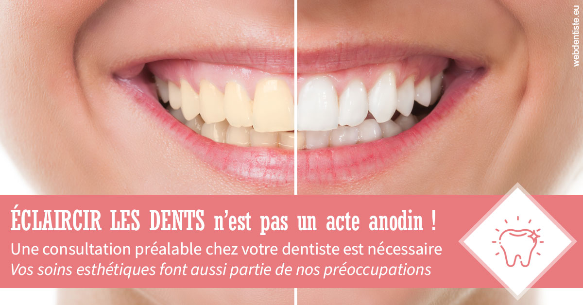 https://www.dr-chavrier-orthodontie-neuville.fr/Eclaircir les dents 1