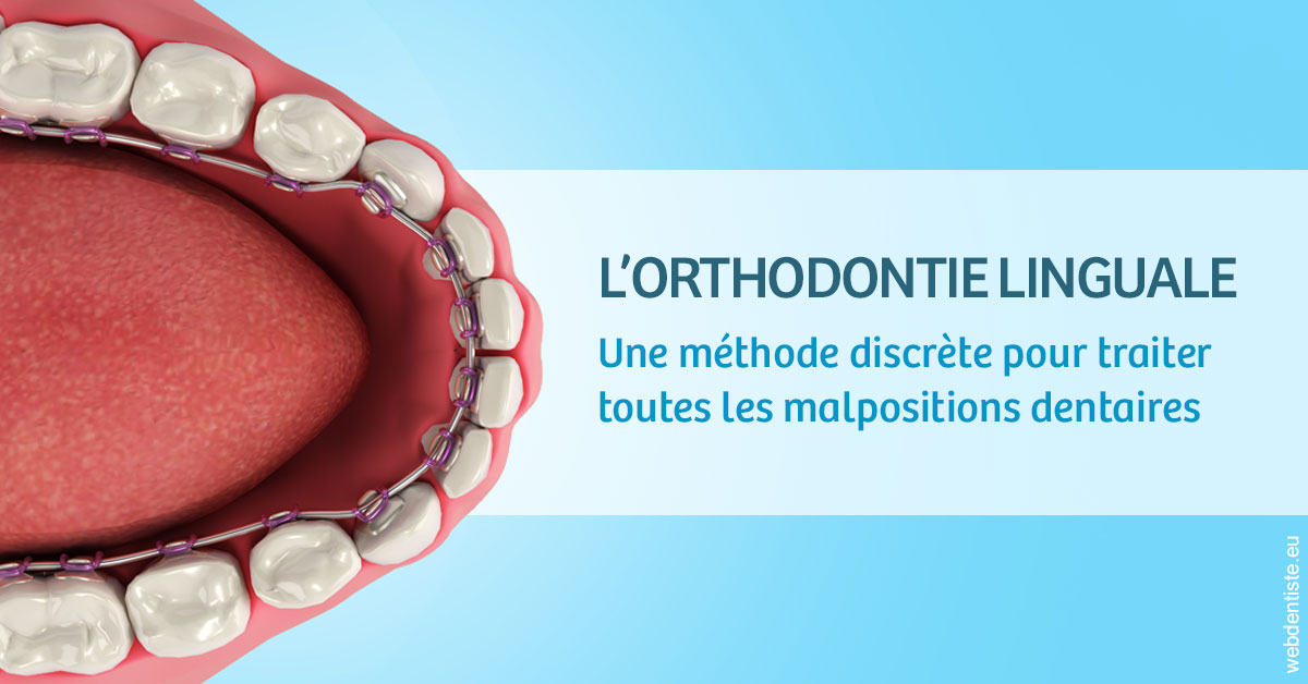 https://www.dr-chavrier-orthodontie-neuville.fr/L'orthodontie linguale 1