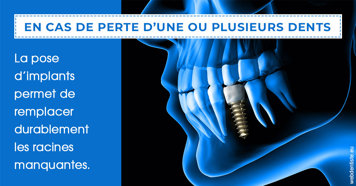 https://www.dr-chavrier-orthodontie-neuville.fr/2024 T1 - Implants 01