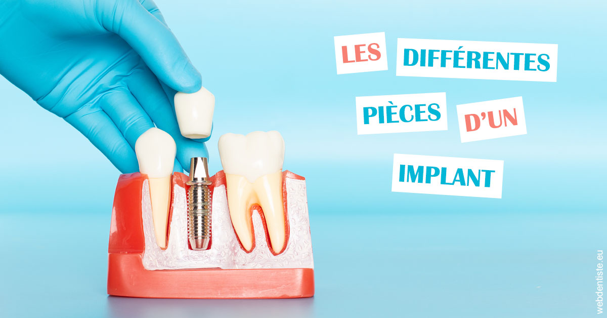 https://www.dr-chavrier-orthodontie-neuville.fr/Les différentes pièces d’un implant 2