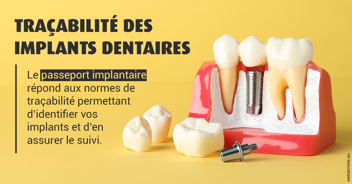 https://www.dr-chavrier-orthodontie-neuville.fr/T2 2023 - Traçabilité des implants 2