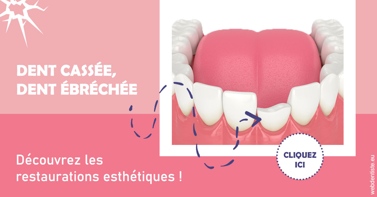 https://www.dr-chavrier-orthodontie-neuville.fr/Dent cassée ébréchée 1