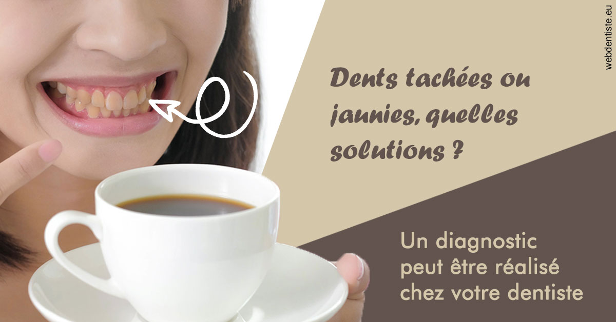 https://www.dr-chavrier-orthodontie-neuville.fr/Dents tachées 1