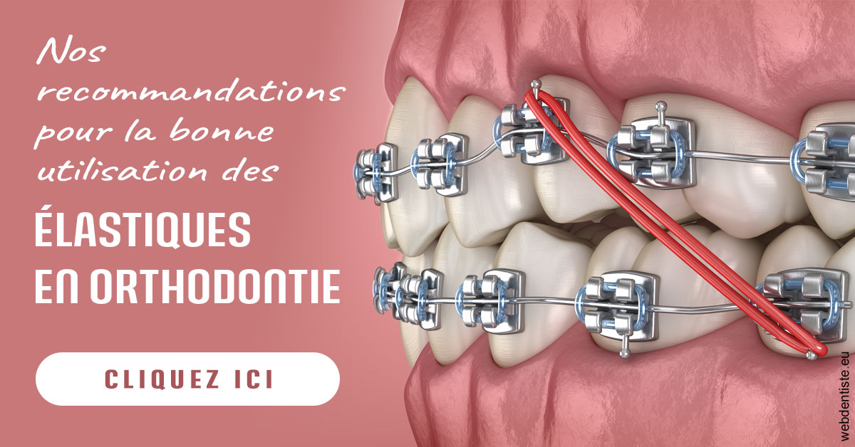 https://www.dr-chavrier-orthodontie-neuville.fr/Elastiques orthodontie 2