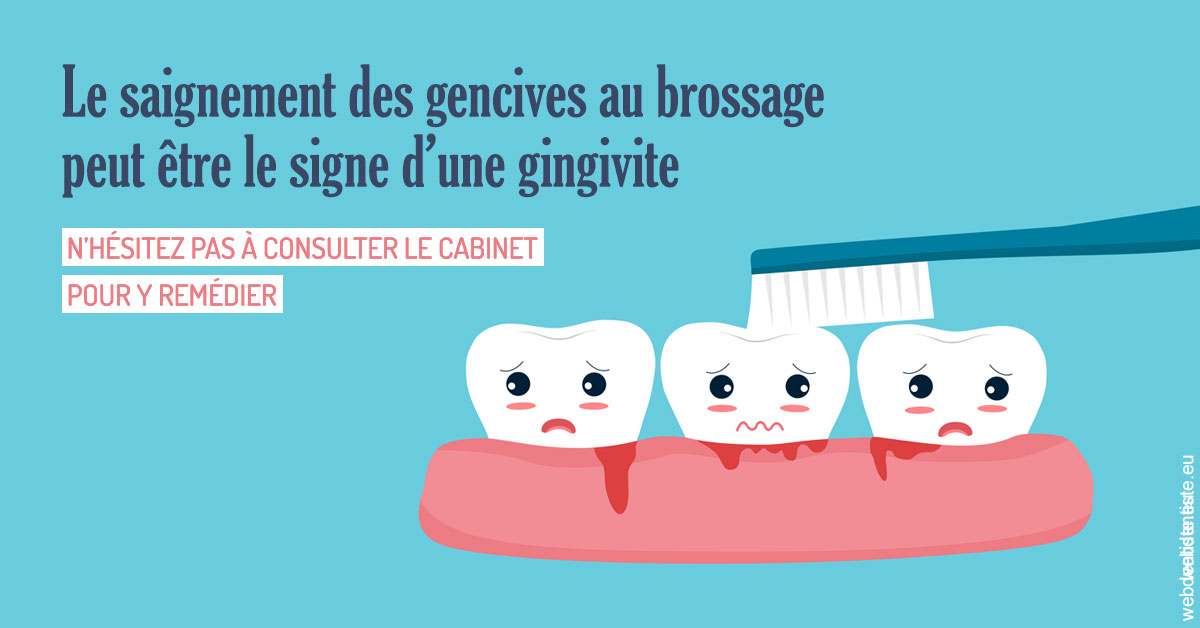 https://www.dr-chavrier-orthodontie-neuville.fr/2023 T4 - Saignement des gencives 02